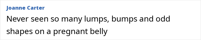 Comment highlighting unusual lumps and bumps on a pregnant belly in Meghan Markle’s twerking pregnancy video fueling conspiracy theories. Comment highlighting unusual lumps and bumps on a pregnant belly in Meghan Markle’s twerking pregnancy video fueling conspiracy theories.