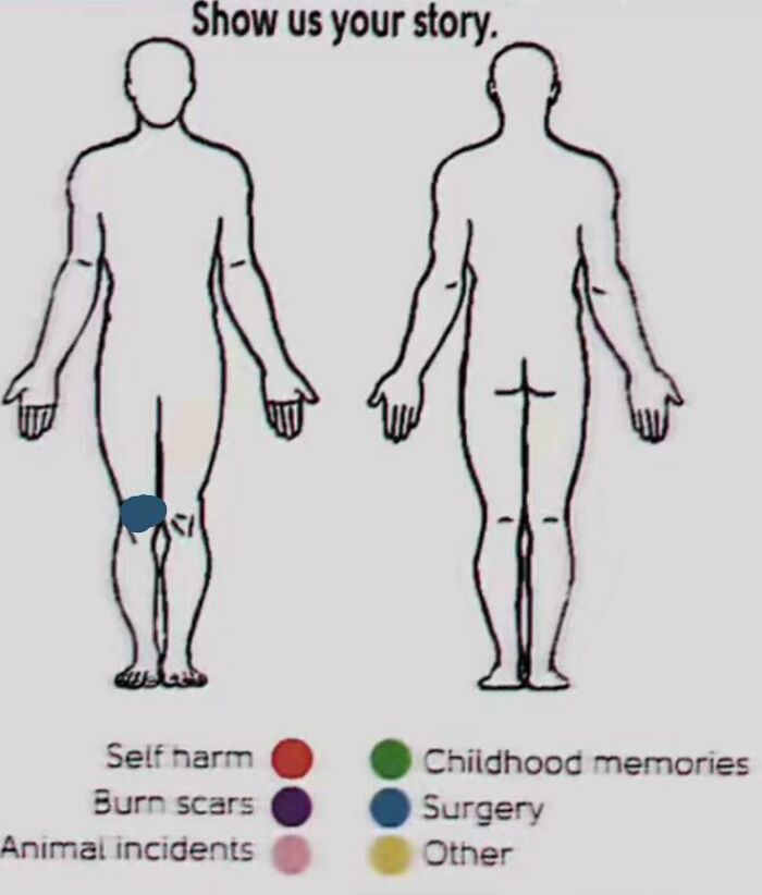 Outline of a front and back human figure with colored dots for surgery, s*******m, and other marks, mocking internet lies humorously.