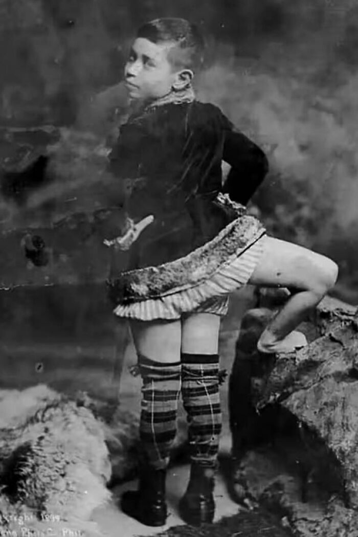 Black and white photo of a person wearing old-fashioned clothing with one leg raised, creating a creepy and unsettling vibe.