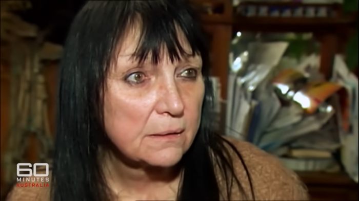 Woman showing appearance 16 years after face transplant following chimpanzee attack, sitting indoors in a casual setting. Woman showing appearance 16 years after face transplant following chimpanzee attack, sitting indoors in a casual setting.