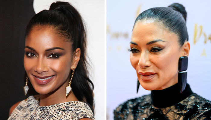 Nicole Scherzinger showing a drastic transformation with doctors noting possible Ozempic side effect in close-up photos. Nicole Scherzinger showing a drastic transformation with doctors noting possible Ozempic side effect in close-up photos.