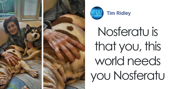 “Ozempic Hands” Is The Latest Skinny Side Effect No One Asked For: “Excuse Me While I Throw Up”