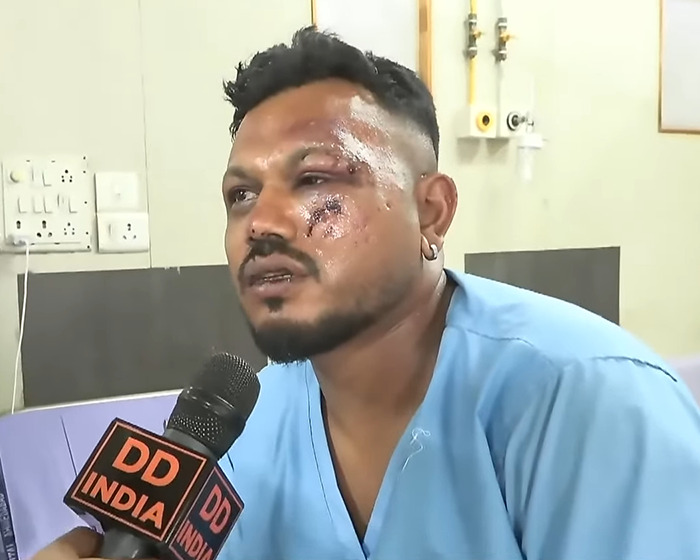Injured man in blue hospital gown speaking to DD India reporter about Air India plane crash investigation. Injured man in blue hospital gown speaking to DD India reporter about Air India plane crash investigation.