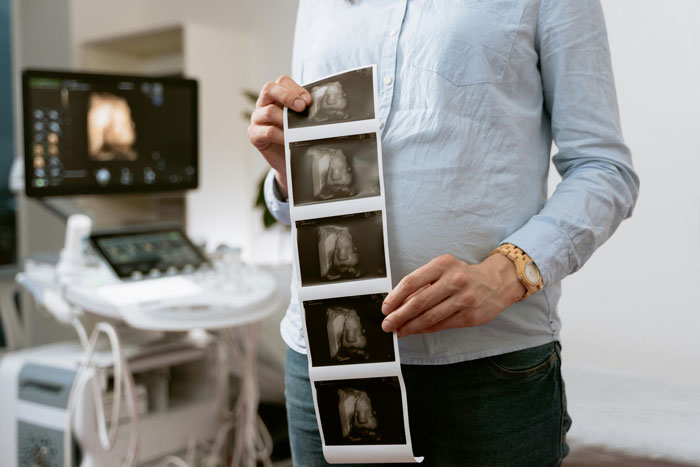 Pregnant woman holding ultrasound images in a clinic, highlighting concerns about baby’s gender and family conflict. Pregnant woman holding ultrasound images in a clinic, highlighting concerns about baby’s gender and family conflict.