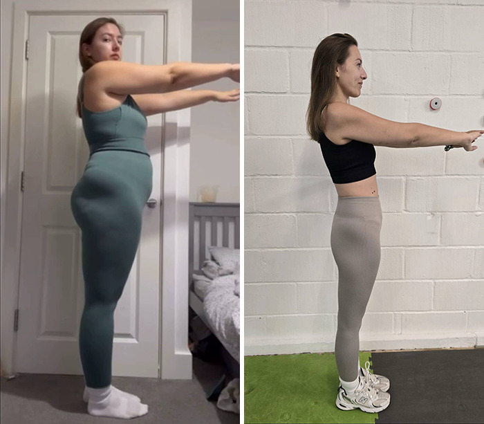 Side-by-side images showing a woman before and after weight loss using Mounjaro, highlighting changes and possible side effects. Side-by-side images showing a woman before and after weight loss using Mounjaro, highlighting changes and possible side effects.