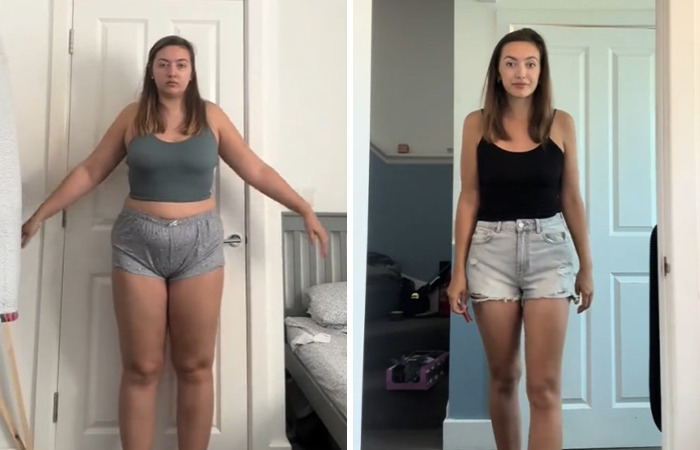 Before and after weight loss photos of a woman who dropped 84 lbs on Mounjaro showing side effects and transformation. Before and after weight loss photos of a woman who dropped 84 lbs on Mounjaro showing side effects and transformation.