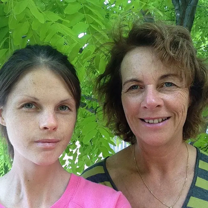 Australian woman and another person outdoors under green leaves, related to excessive caffeine consumption risks. Australian woman and another person outdoors under green leaves, related to excessive caffeine consumption risks.