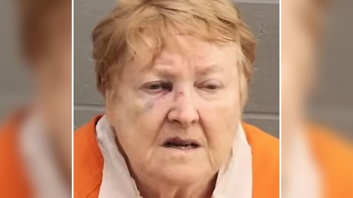Older woman known as Bagpipe Karen with visible facial bruises after altercation in park incident.