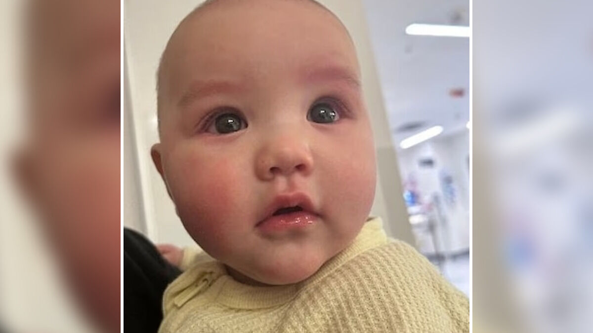 Close-up of 5-month-old baby with concerned expression, highlighting hospital visit after fire extinguisher prank incident.