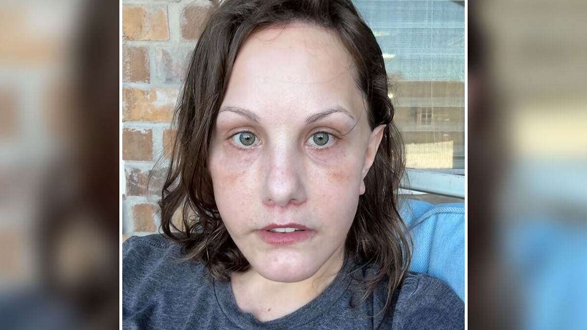 Woman's facelift before photo showing natural face with minimal makeup and neutral expression sitting against brick wall background
