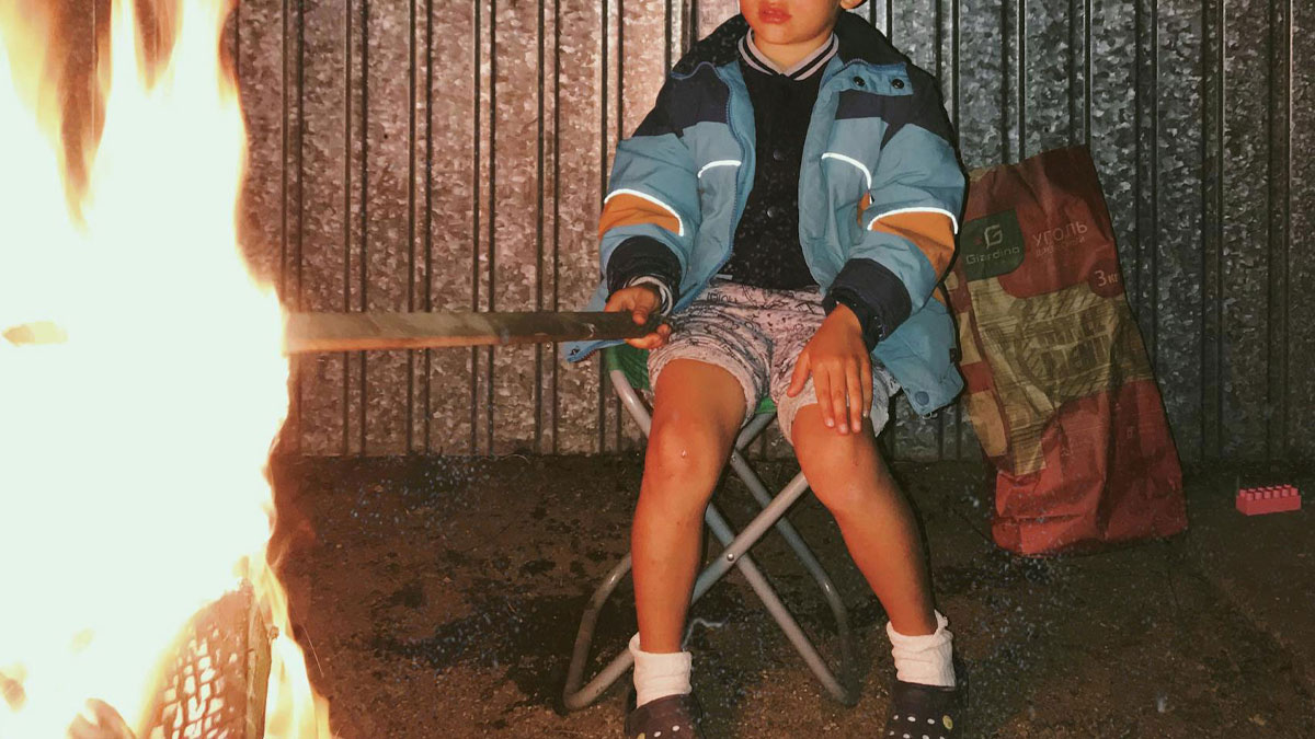 Child with bandaged legs sitting near fire, illustrating one of the most insane hospital experiences shared in stories.