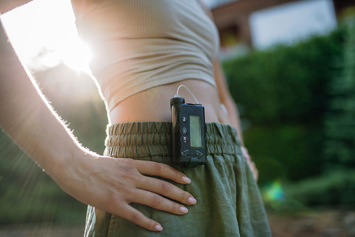 Close-up of woman wearing insulin pump on waist, prioritizing health over sister’s wedding photo aesthetic concerns. Close-up of woman wearing insulin pump on waist, prioritizing health over sister’s wedding photo aesthetic concerns.
