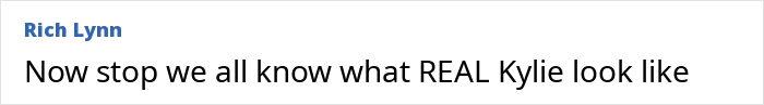 Text post reading Now stop we all know what REAL Kylie look like discussing Ozempic hands. Text post reading Now stop we all know what REAL Kylie look like discussing Ozempic hands.