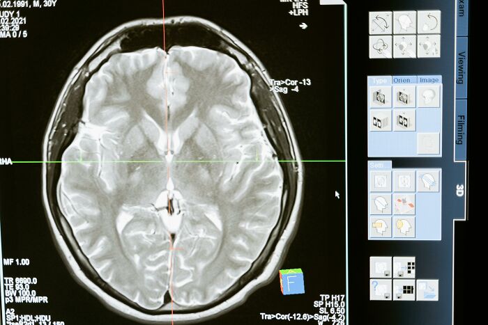 MRI brain scan image showing detailed cross-section used in diagnosing local dangers and health risks.