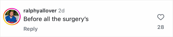 Social media comment saying before all the surgery's in a discussion about Kim Kardashian’s plastic surgeries. Social media comment saying before all the surgery's in a discussion about Kim Kardashian’s plastic surgeries.