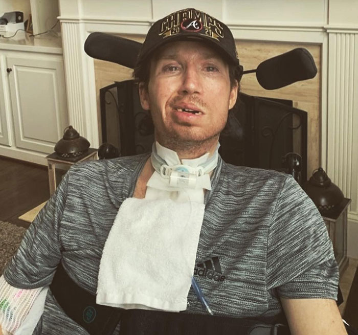 Man with locked-in syndrome sitting in a wheelchair after visiting a chiropractor for neck pain treatment at home. Man with locked-in syndrome sitting in a wheelchair after visiting a chiropractor for neck pain treatment at home.