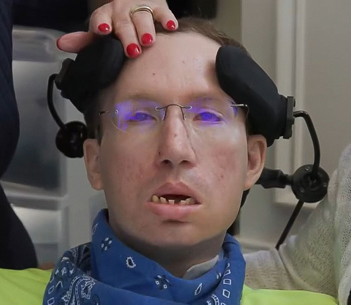 Man with locked-in syndrome sitting in a chair, wearing glasses and a blue bandana, assisted by a caregiver. Man with locked-in syndrome sitting in a chair, wearing glasses and a blue bandana, assisted by a caregiver.