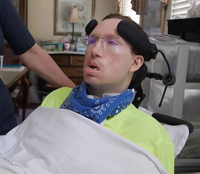 Man in a wheelchair with neck pain and locked-in syndrome after visiting a chiropractor, supported by caregiver at home. Man in a wheelchair with neck pain and locked-in syndrome after visiting a chiropractor, supported by caregiver at home.