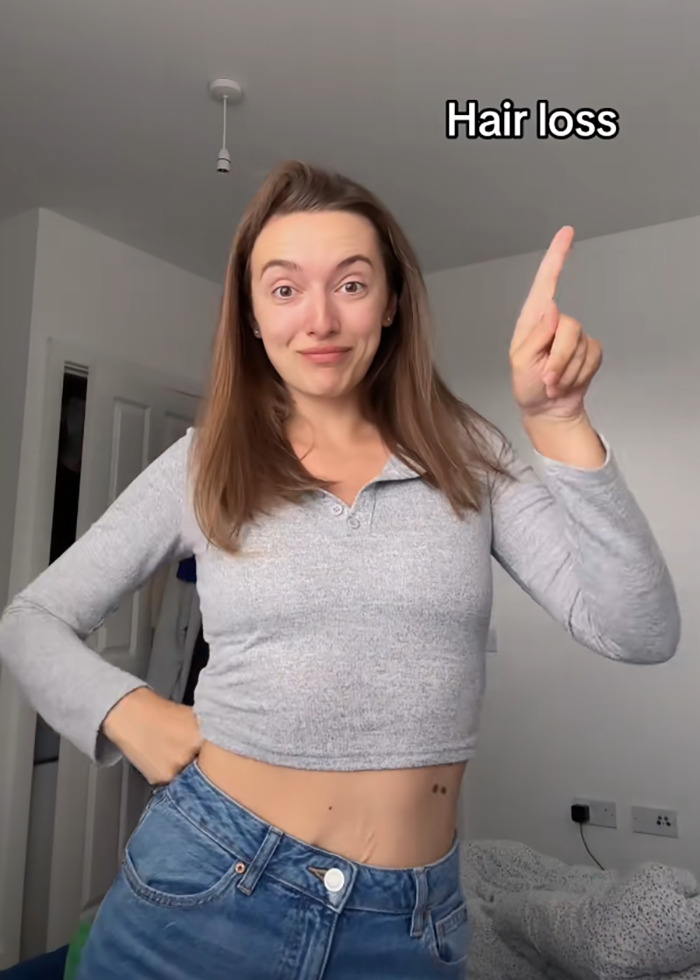 Woman pointing to text about hair loss, discussing side effects of Mounjaro after significant weight loss. Woman pointing to text about hair loss, discussing side effects of Mounjaro after significant weight loss.