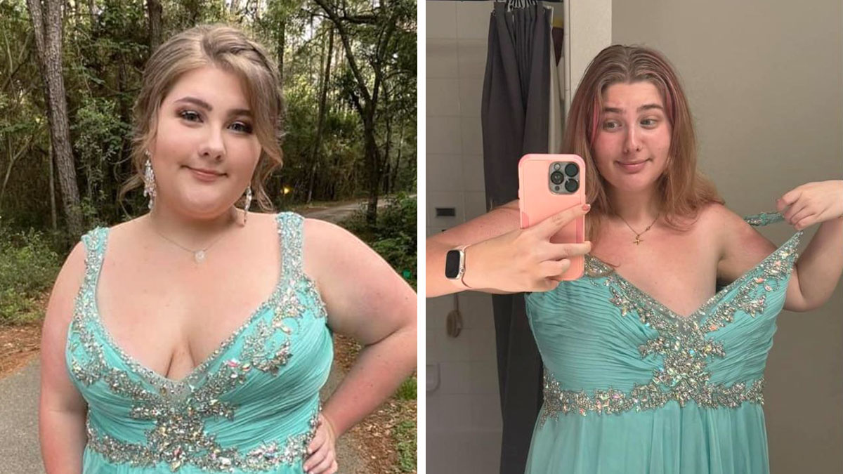 Side-by-side major weight loss before and after photos of a woman showing results with Ozempic and effort.