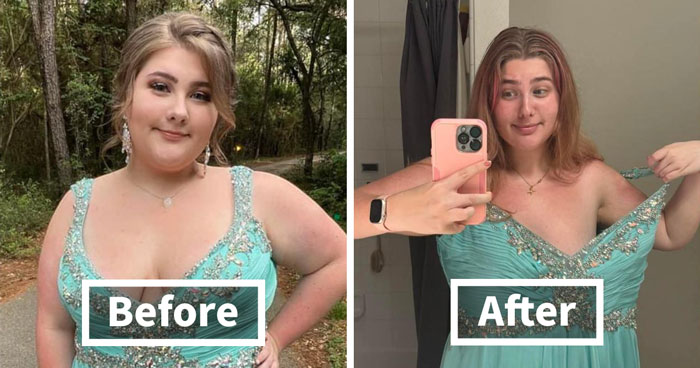 40 Pictures Showing How People Looked Before And After Choosing Ozempic As A Weight Loss Solution