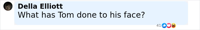 Comment on social media questioning Tom Cruise's face, sparking Botox rumors after F1 premiere with Brad Pitt. Comment on social media questioning Tom Cruise's face, sparking Botox rumors after F1 premiere with Brad Pitt.