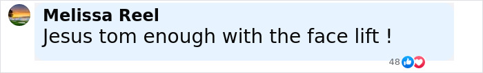 Comment about Tom Cruise sparking botox rumors after reuniting with Brad Pitt at F1 premiere displayed on a social media post. Comment about Tom Cruise sparking botox rumors after reuniting with Brad Pitt at F1 premiere displayed on a social media post.