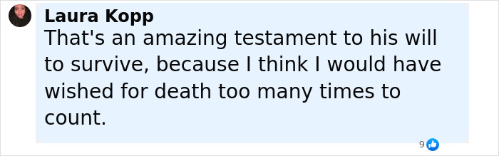 Comment by Laura Kopp expressing admiration for a man's will to survive after a painful face transplant coma. Comment by Laura Kopp expressing admiration for a man's will to survive after a painful face transplant coma.
