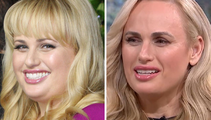 Nicole Scherzinger showing a drastic transformation in side-by-side photos linked to possible Ozempic side effects. Nicole Scherzinger showing a drastic transformation in side-by-side photos linked to possible Ozempic side effects.