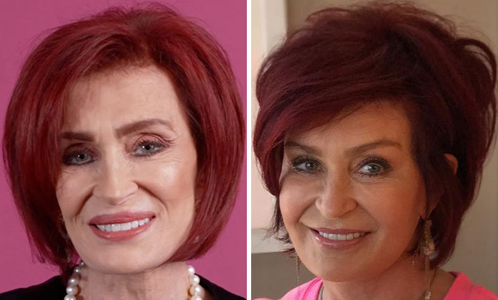 Nicole Scherzinger with red hair showing a drastic transformation, highlighting possible Ozempic side effect as noted by doctors. Nicole Scherzinger with red hair showing a drastic transformation, highlighting possible Ozempic side effect as noted by doctors.