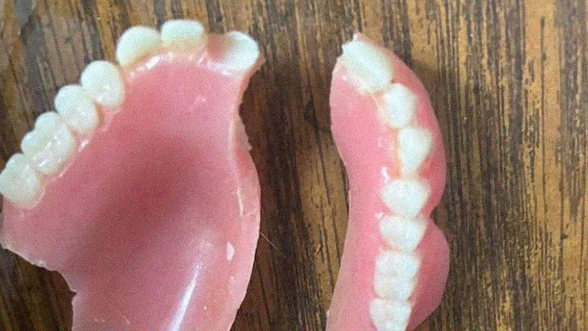 Broken dentures with teeth pieces on a wooden surface, highlighting entitled single moms who avoid paying.