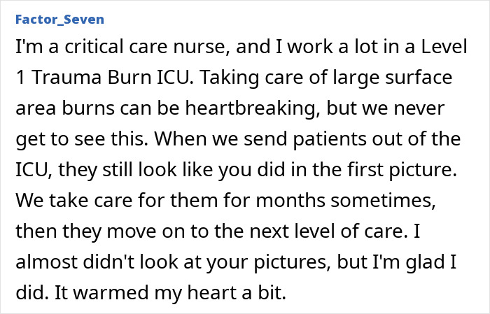 Burn survivor from gas station explosion shows remarkable transformation six years after injury and recovery process. Burn survivor from gas station explosion shows remarkable transformation six years after injury and recovery process.