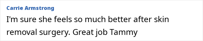 Comment praising Tammy Slaton from 1000-Lb. Sisters, mentioning she feels better after skin removal surgery. Comment praising Tammy Slaton from 1000-Lb. Sisters, mentioning she feels better after skin removal surgery.