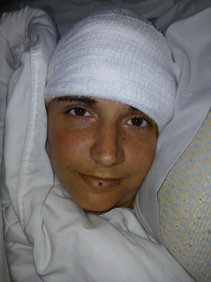 Paralyzed woman wearing head bandage resting in bed, demonstrating effects of Elon Musk Neuralink brain chip technology. Paralyzed woman wearing head bandage resting in bed, demonstrating effects of Elon Musk Neuralink brain chip technology.