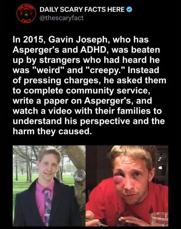 Before and after photos of a man who was attacked, illustrating a scary fact about understanding and harm caused. Before and after photos of a man who was attacked, illustrating a scary fact about understanding and harm caused.