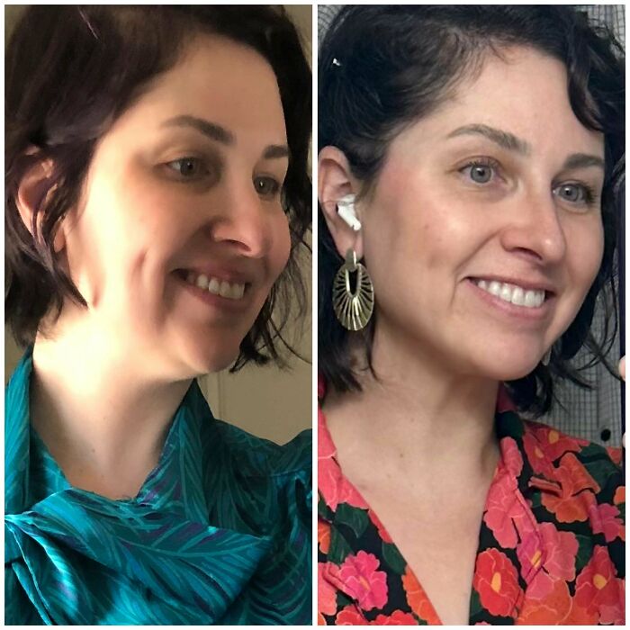 Side-by-side before and after plastic surgery photos showing transformation from mom to Beverly Hills housewife look.