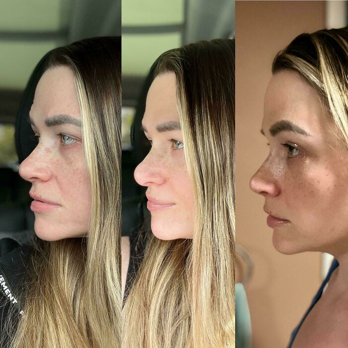 Side-by-side before and after plastic surgery photos showing transformation from a mom at Costco to a Beverly Hills housewife.