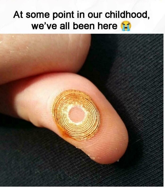 Close-up of a fingertip with a peeled circular bandage, evoking nostalgic pics from people realizing they’re old now.