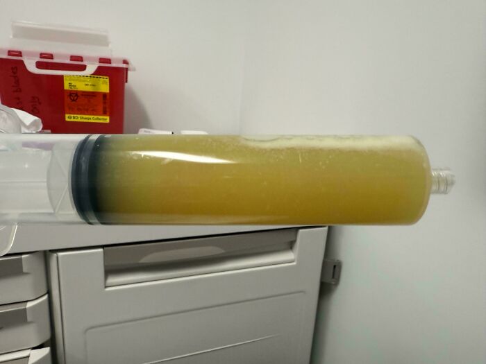 medical pics large syringe filled with yellow cloudy fluid resting above a cabinet in a clinical room