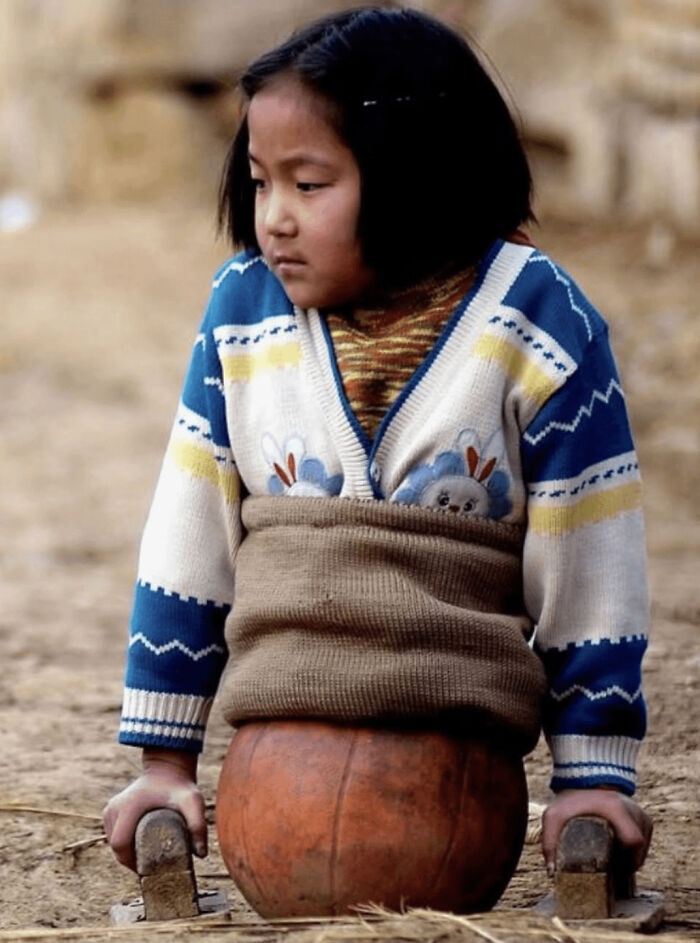Young child with lower-limb disability using wooden supports outdoors, wearing patterned sweater, medical pics