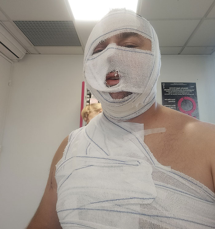 Man with extensive bandages on face and shoulder in a medical setting after domestic violence injury and hospitalization. Man with extensive bandages on face and shoulder in a medical setting after domestic violence injury and hospitalization.