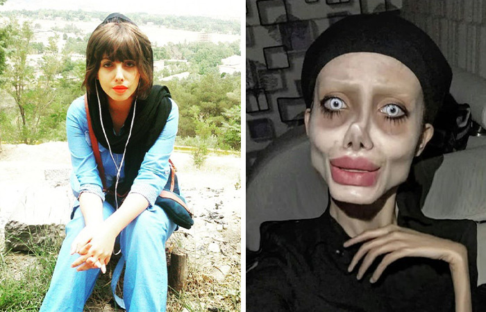 20 Normal People Who Shot To Fame After Getting Extreme Plastic Surgery 20-normal-people-who-shot-to-fame-after-getting-extreme-plastic-surgery
