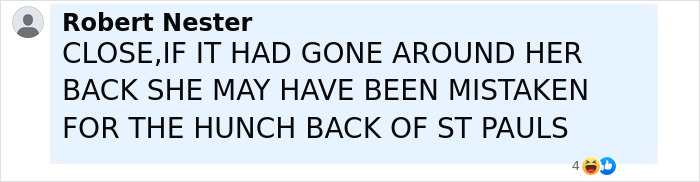 Comment from Robert Nester in uppercase text expressing a thought about a woman and a hunchback, related to plastic surgery recovery. Comment from Robert Nester in uppercase text expressing a thought about a woman and a hunchback, related to plastic surgery recovery.