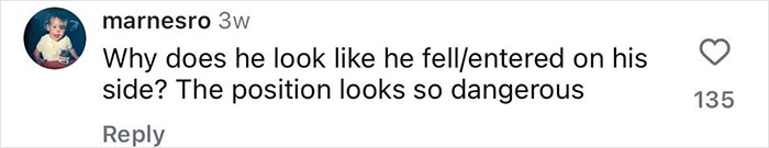 Comment on social media post questioning the dangerous position of a 21-year-old daredevil after a record-breaking dive injury. Comment on social media post questioning the dangerous position of a 21-year-old daredevil after a record-breaking dive injury.
