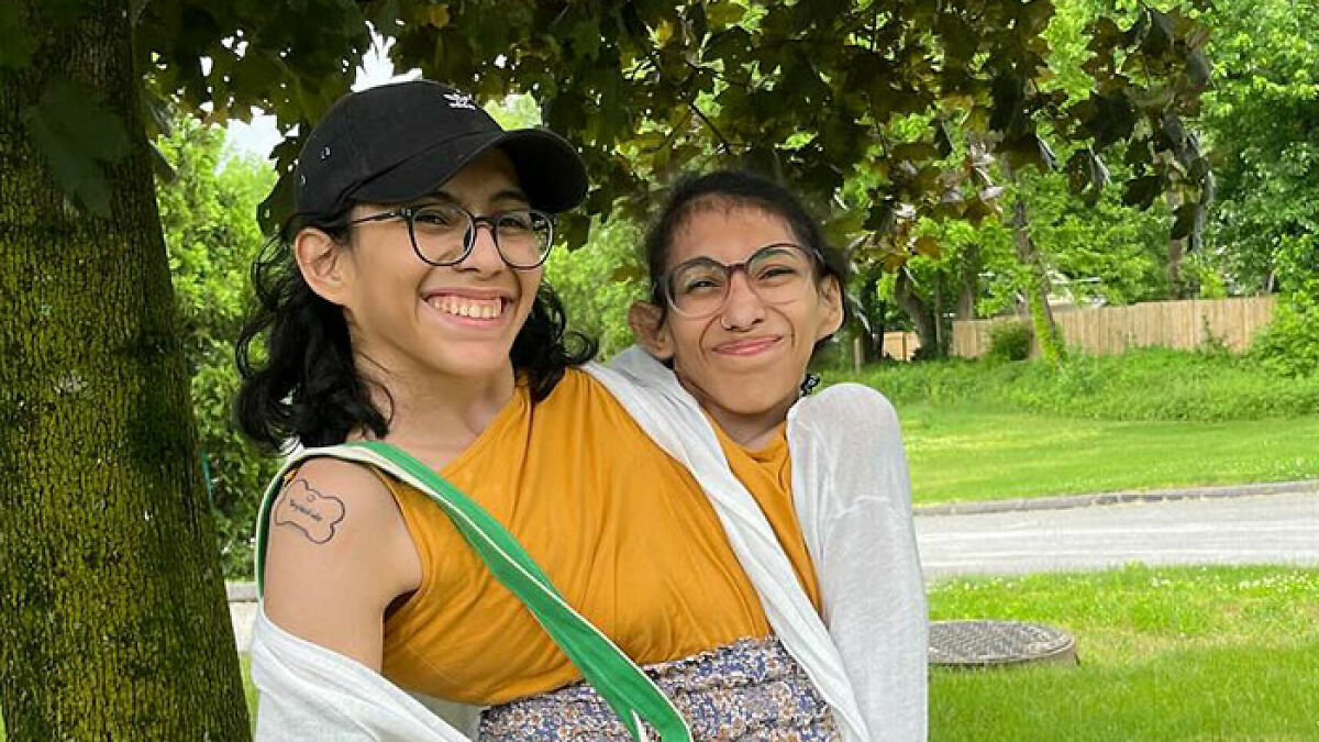 Conjoined twin influencer smiling outdoors wearing glasses and an orange top, standing under a tree on a sunny day.