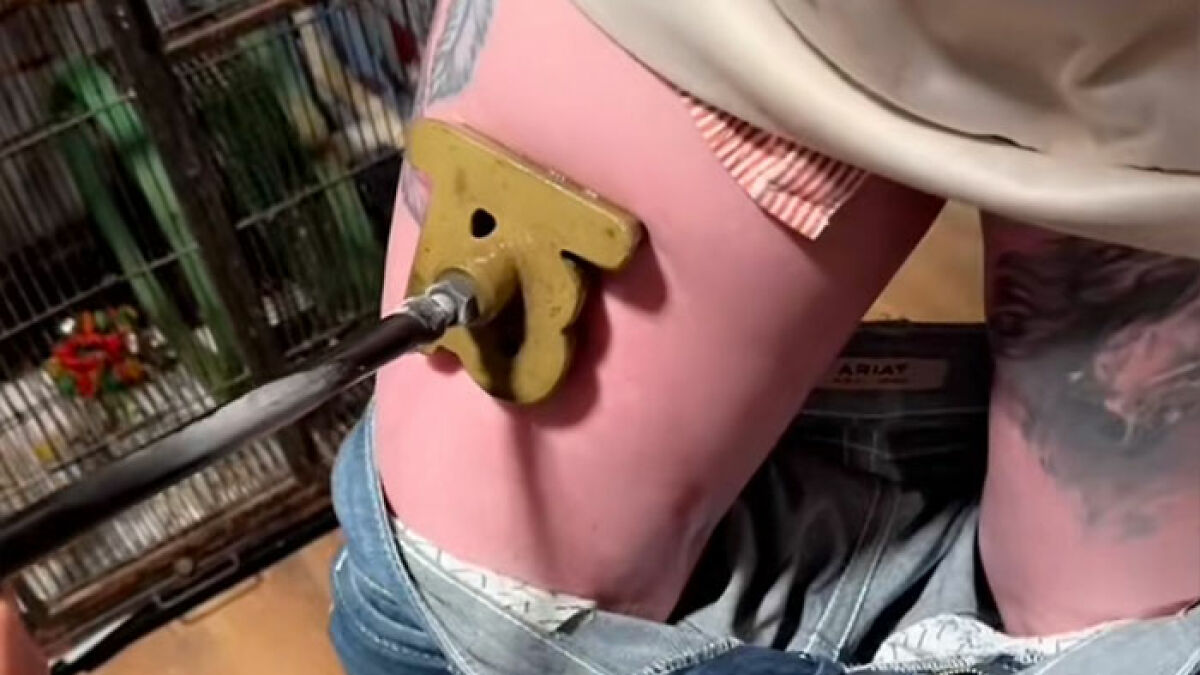 Close-up of a person receiving a freeze branding tattoo alternative on their hip, highlighting associated health risks.