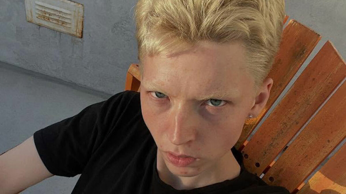 Model pushed to transition at 15, now detransitions, expressing struggle with identity and pressure to be a man.