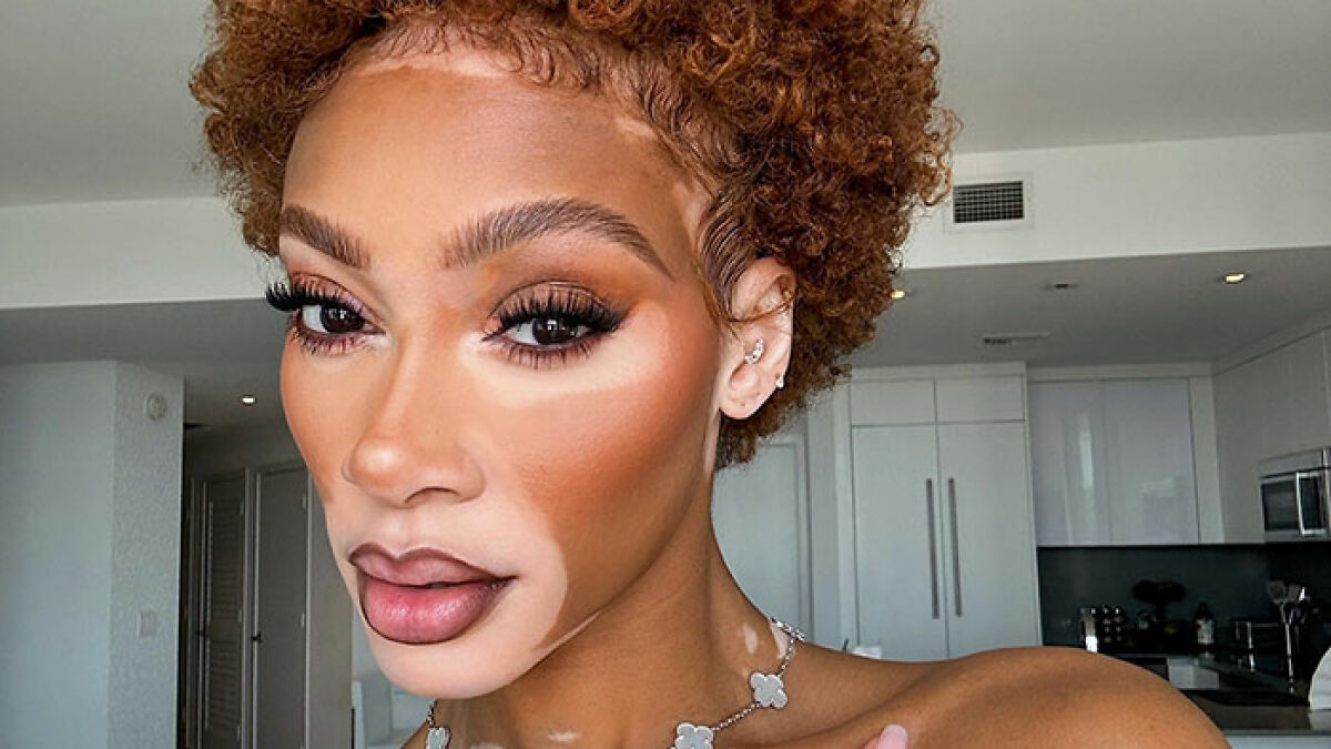 Winnie Harlow close-up portrait showcasing her skin condition, posing indoors with natural makeup and curly hair.