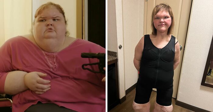 1000-Lb. Sisters’ Tammy Slaton Barely Recognizable After Showing Off Skin Removal Surgery Results