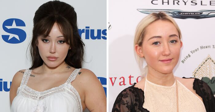 Miley Cyrus’ Sister Noah, 25, Sparks Plastic Surgery Rumors With Dramatic Transformation